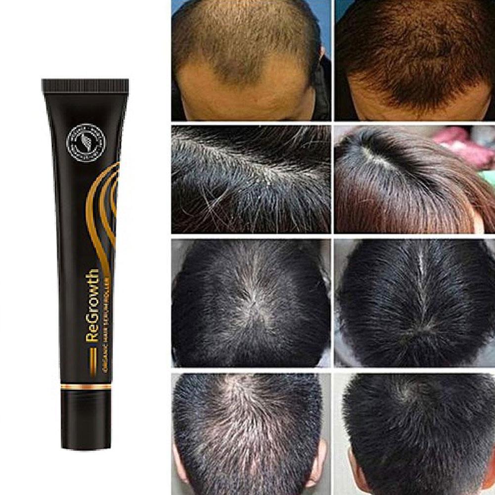 Repair Hair® | Óleo de Crescimento Capilar - Diminui Queda 95% e Aumenta Crescimento